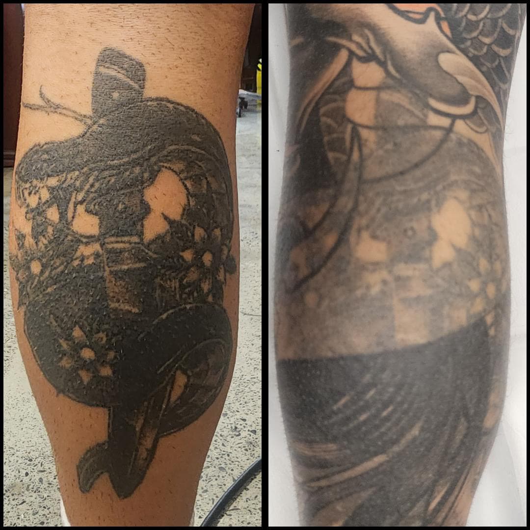 Tattoo removal before and after. By Kat