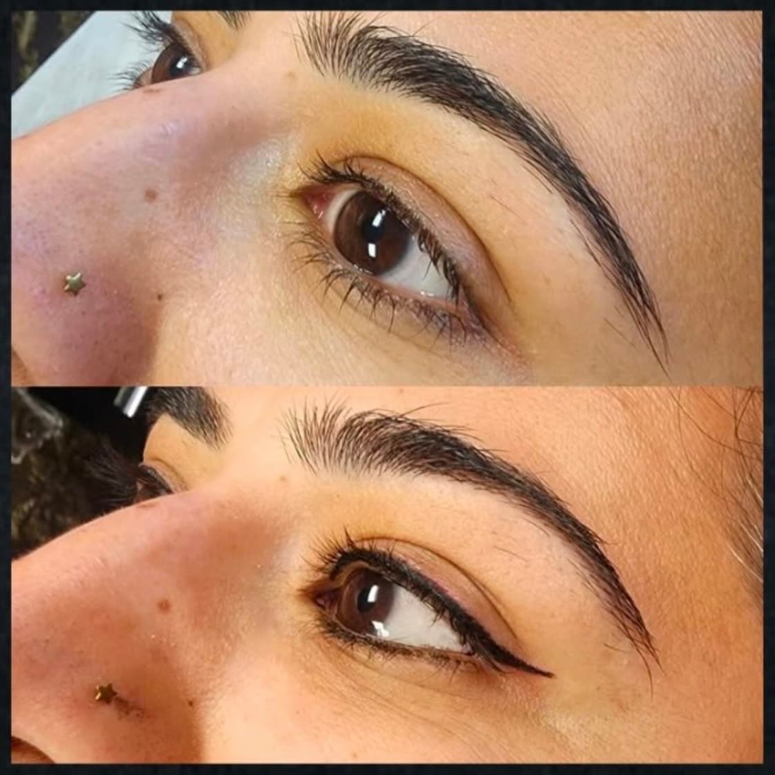 Small tattoo laser removal by Kat