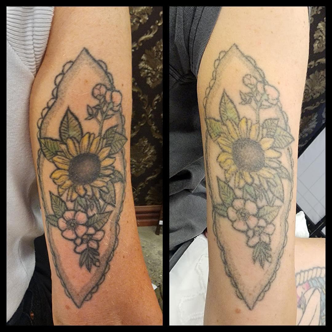 Tattoo removal, 1 session. By Kat