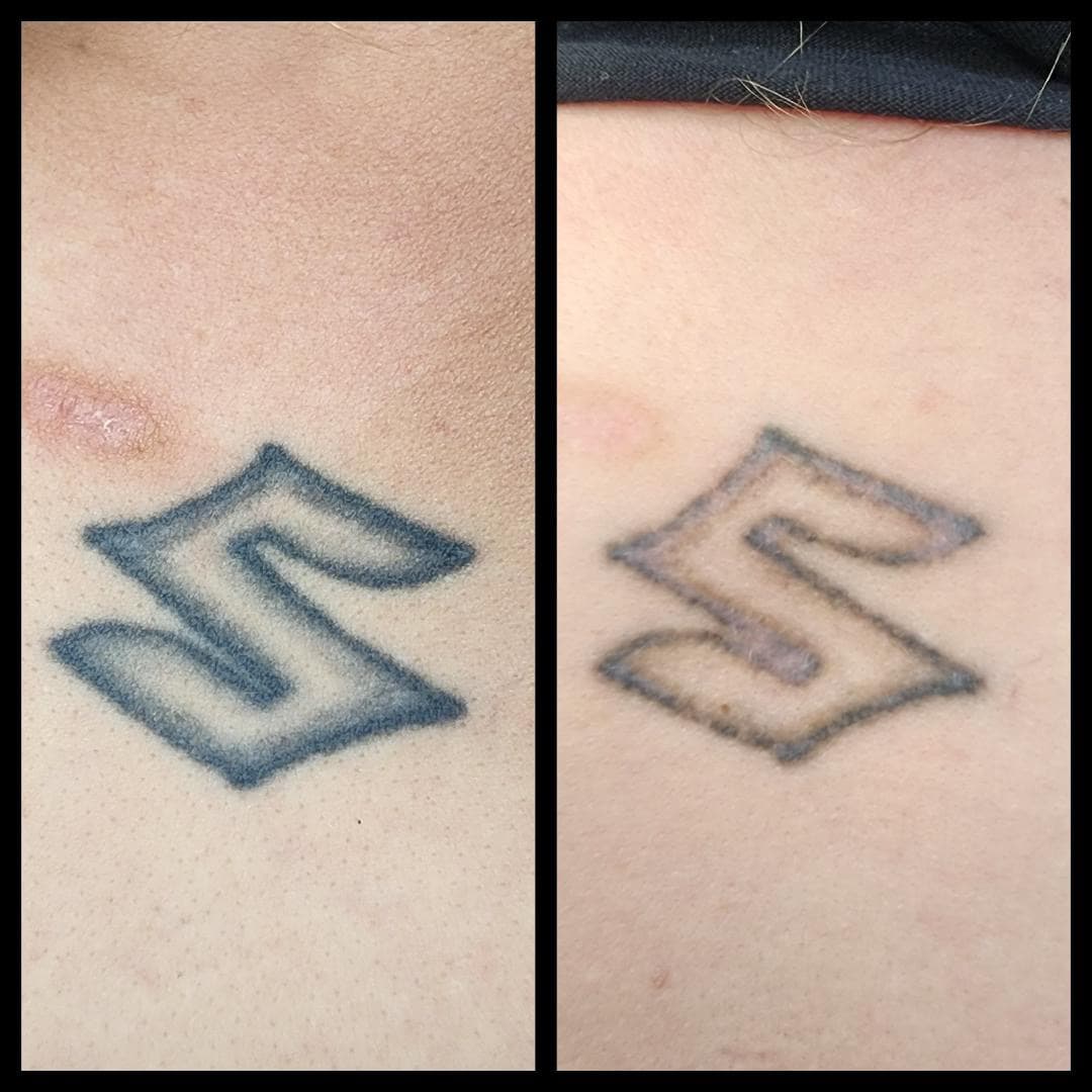 Tattoo removal, 1 session just for a cover up. By Kat