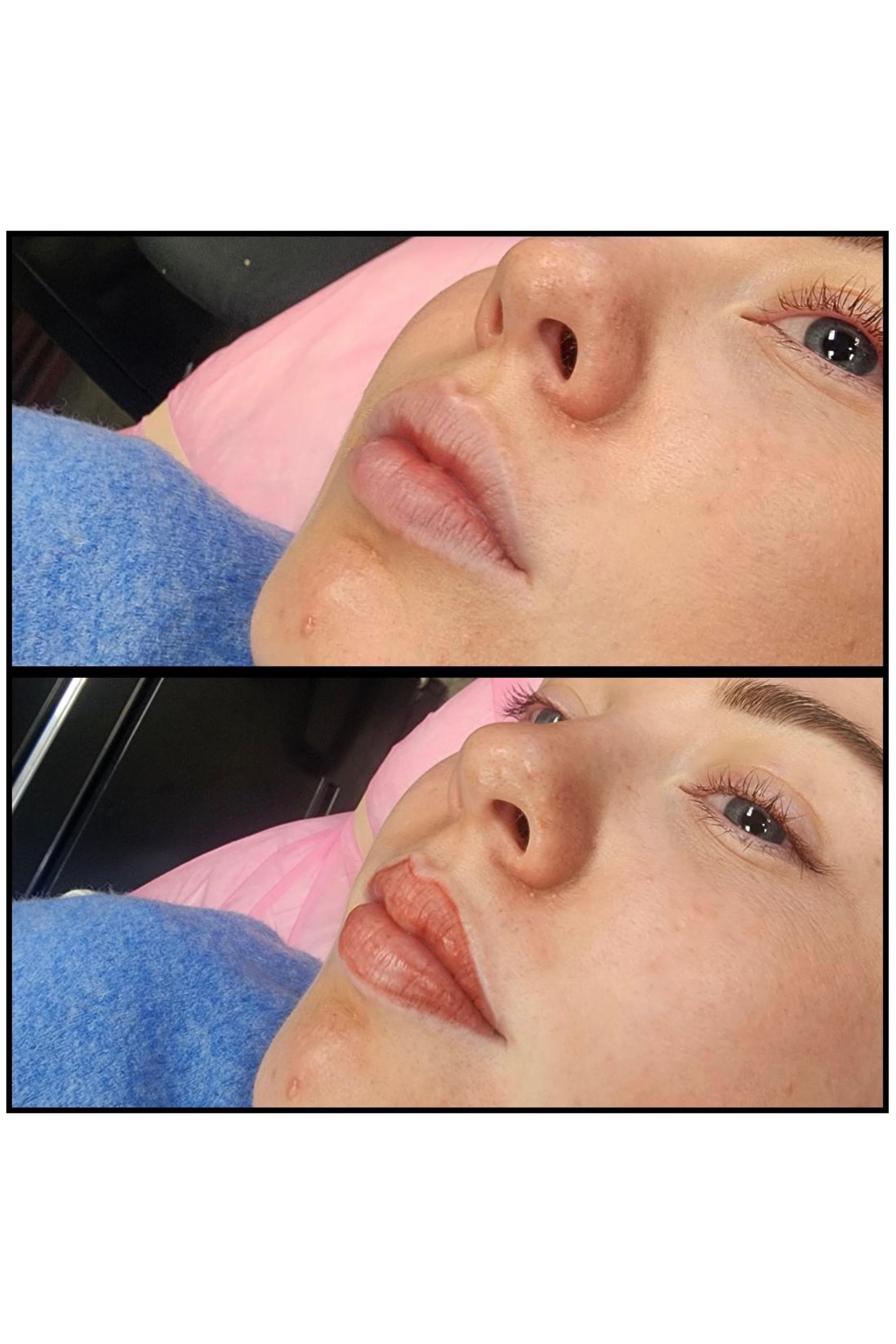 Before and after lips. By Kat
