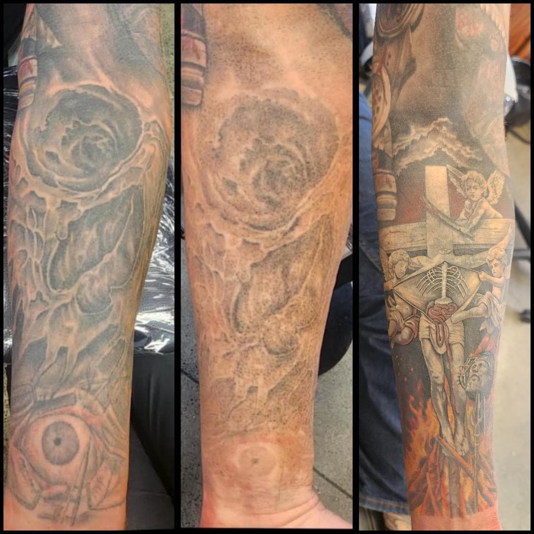 Tattoo removal, 6 sessions so the client can get that cover up. By Kat