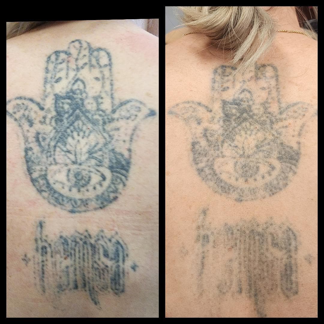 On the left it has had 2 sessions. This photo shows you between a session how light it does go down. By Kat