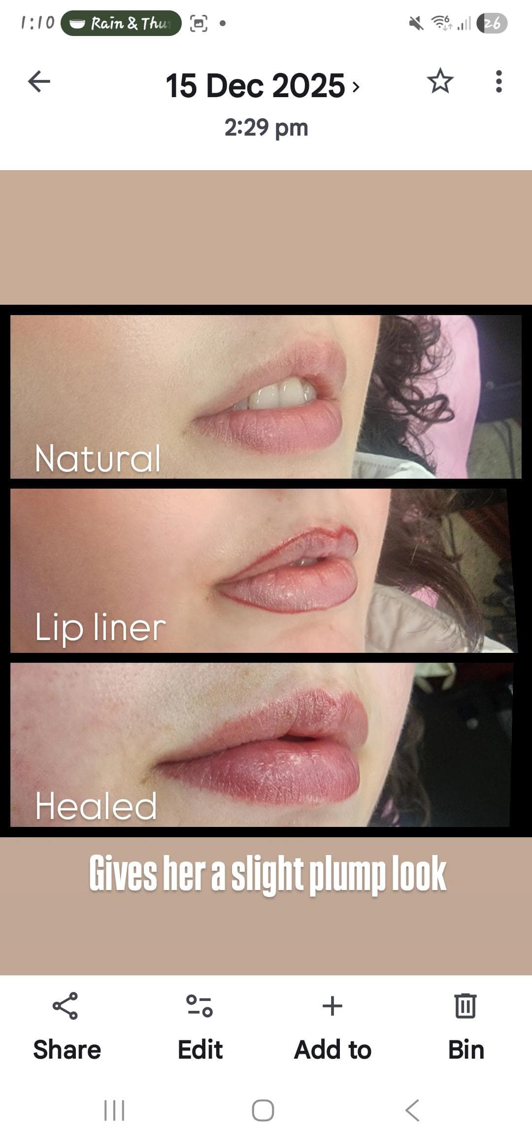 Lip liner tattooed and healed. By Kat