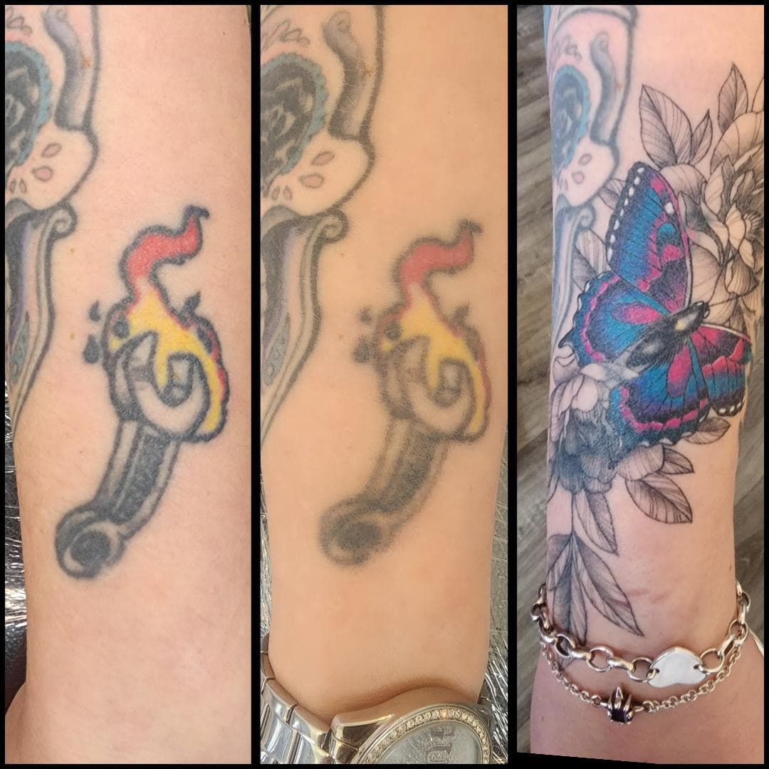 Tattoo removal for that cover up. By Kat