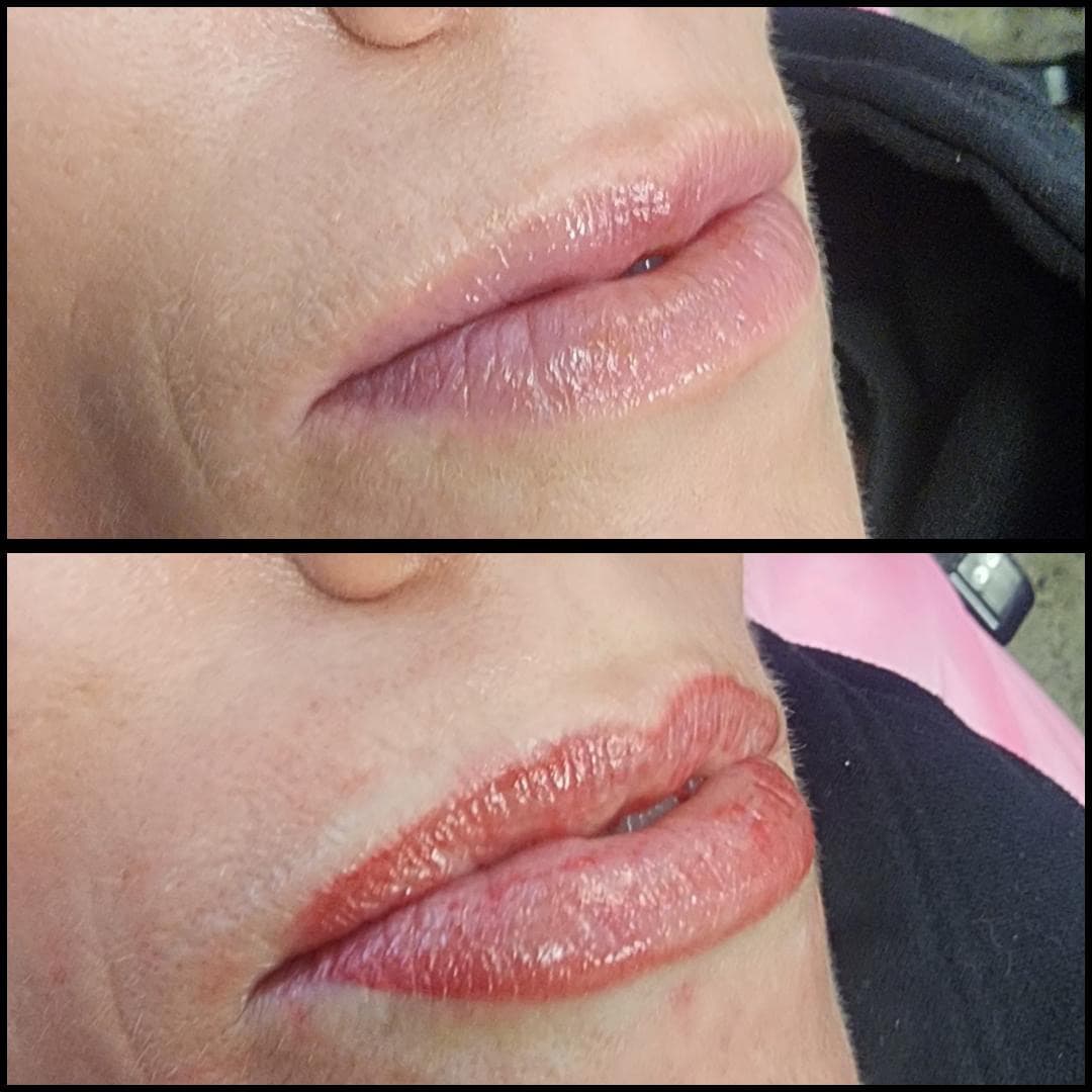 Just defining the lips and with a beautiful tone. By Kat